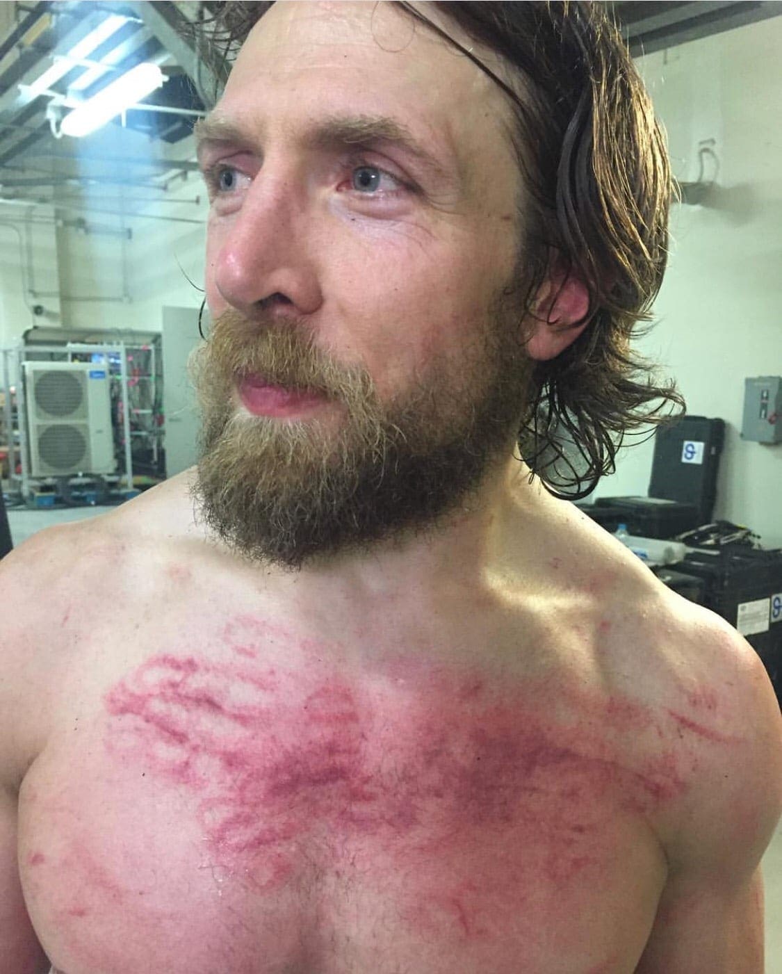 Daniel Bryan Unable To Compete Due To Possible Infection