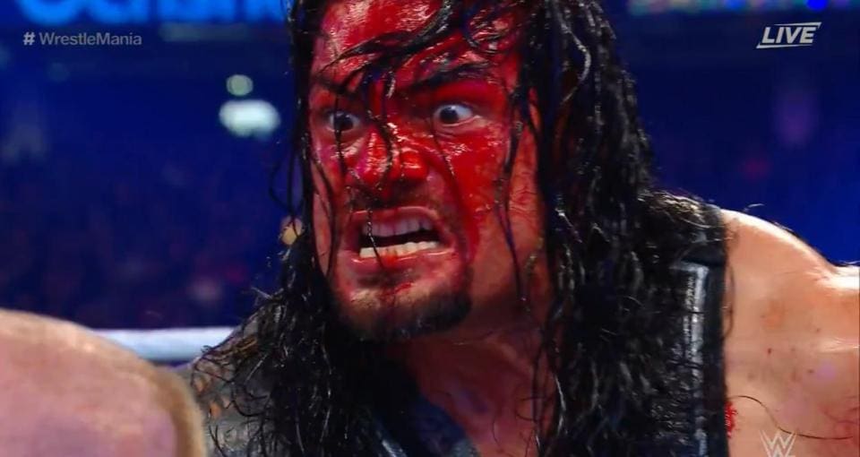 Update On Roman Reigns Bleeding At WrestleMania