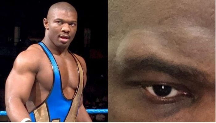 Shelton Benjamin Shows Off Nasty Lump On His Head After Match