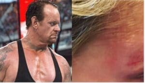 The Undertaker’s Daughter Suffers Easter Egg Hunting Related Injury