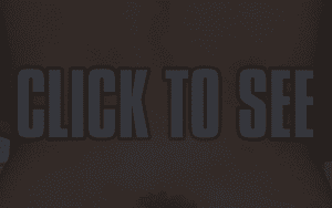 Finn Balor Shares Explicit Picture Of Bruise On His Backside