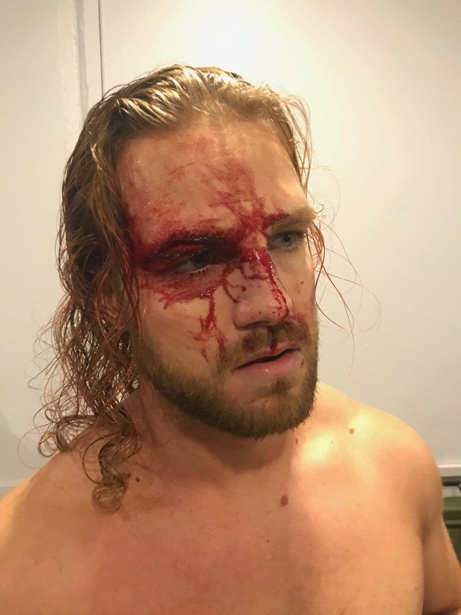 Check Out Adam Page’s Nasty Cut