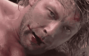 Kenny Omega Suffers Nasty Injury at G1 Climax Event