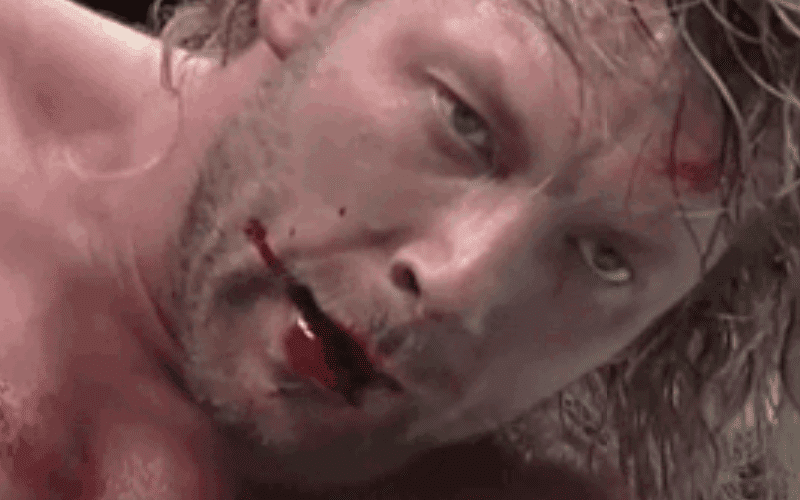Kenny Omega Suffers Nasty Injury at G1 Climax Event