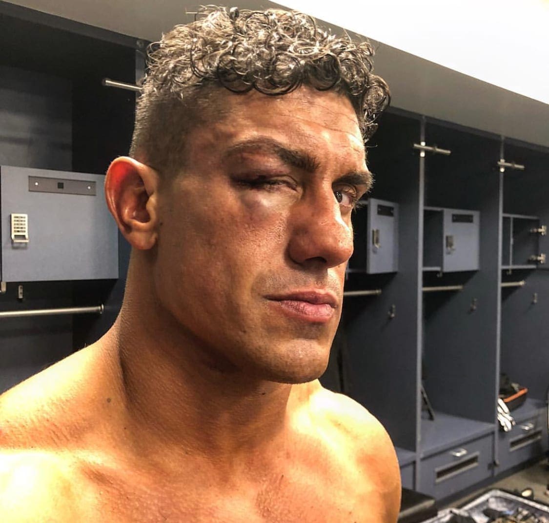 EC3 Still Not Cleared To Wrestle After TakeOver: Brooklyn IV Injury