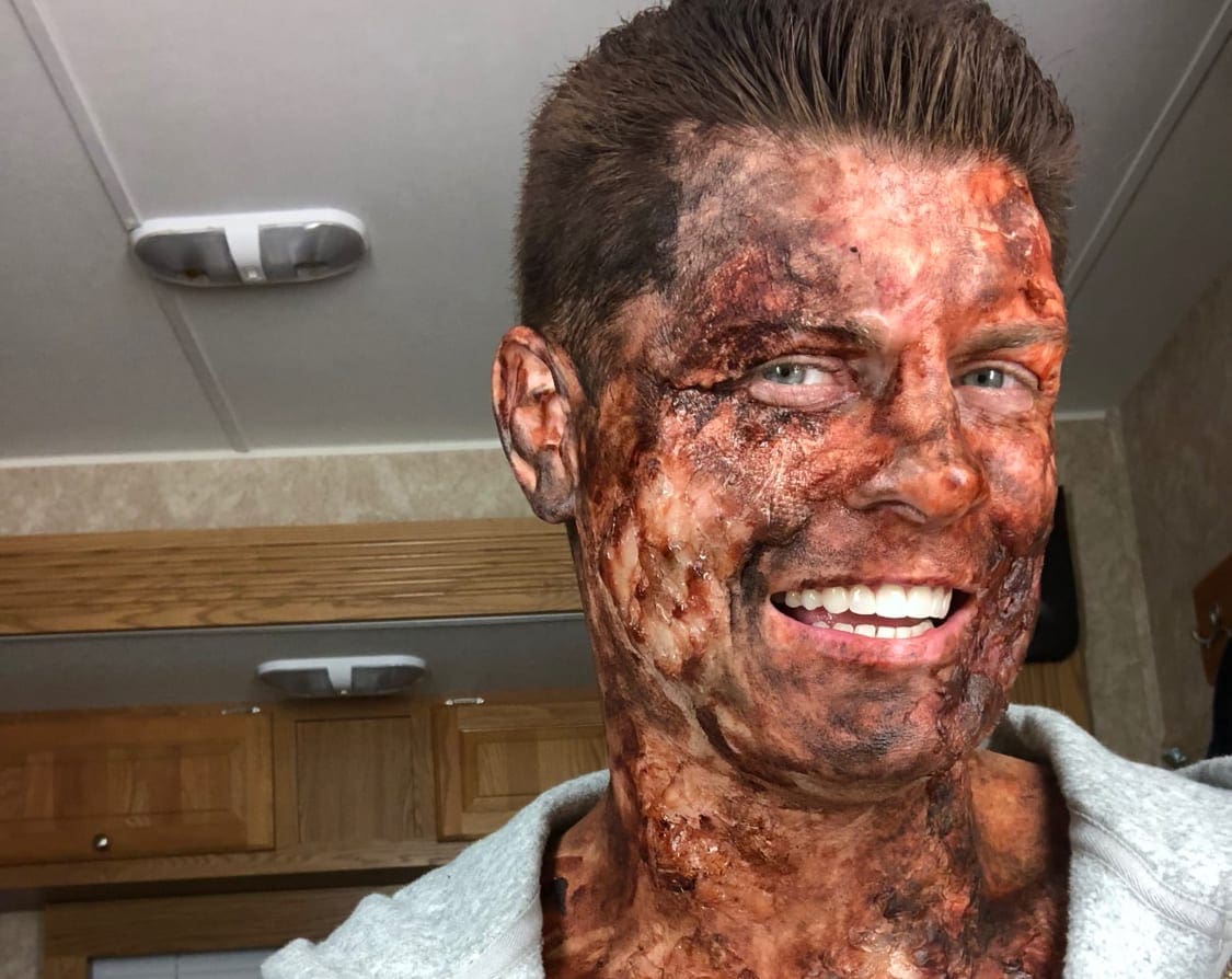 Cody Rhodes Shows Off His Burned Face On The Set Of Arrow