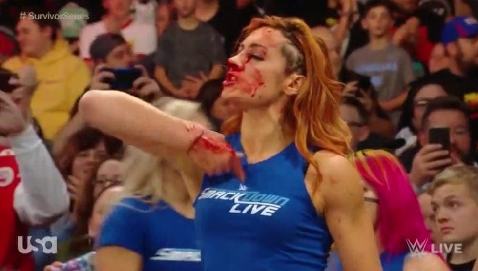 Becky Lynch Comments On Getting Busted Open On WWE Raw