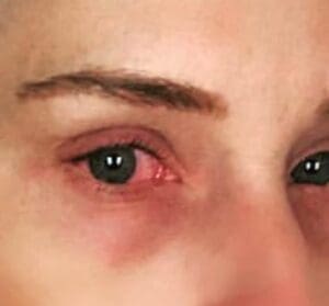 Michelle McCool Suffering From Nasty Issue Right Before Christmas