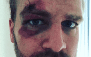 Chris Jericho Apologizes To Hangman Page For Busting His Face At AEW Fight For The Fallen