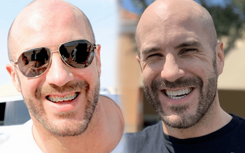 Cesaro Finally Gets His Braces Removed