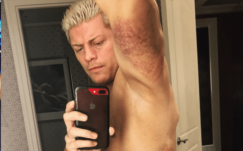 Cody Rhodes Shows Off Insane Bruising From AEW All Out