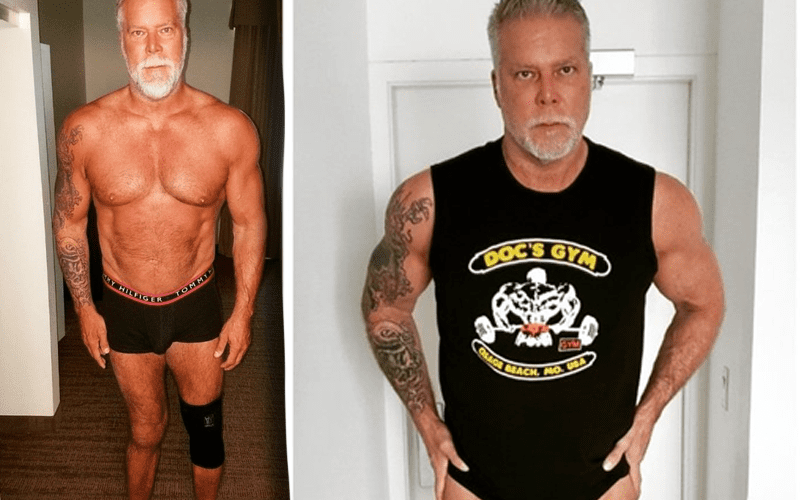 Kevin Nash Reveals Before & After Photos Of His 'Crippled & Deformed' Knees