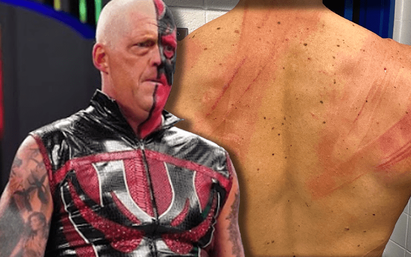 Dustin Rhodes Reacts To Cody Taking 10 Lashes On AEW Dynamite