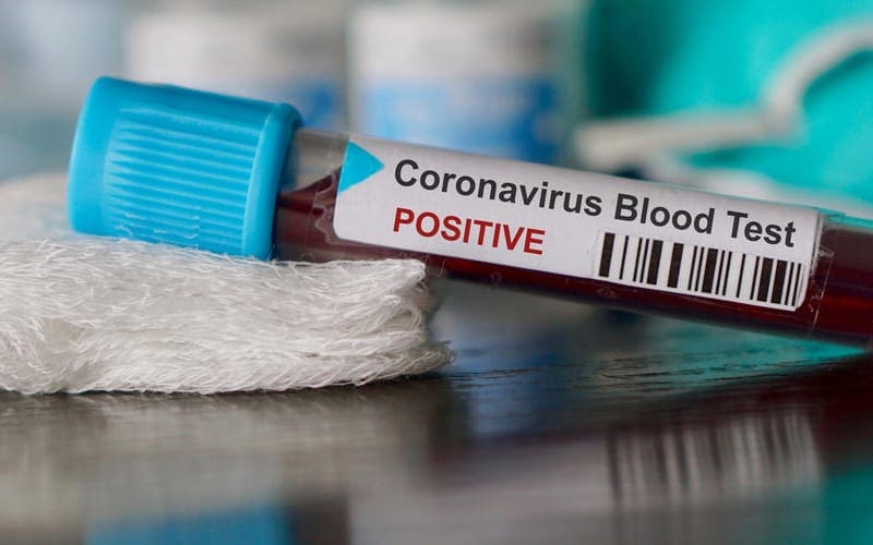 WWE Superstars Reportedly Informed Of Positive Coronavirus Test In The Company
