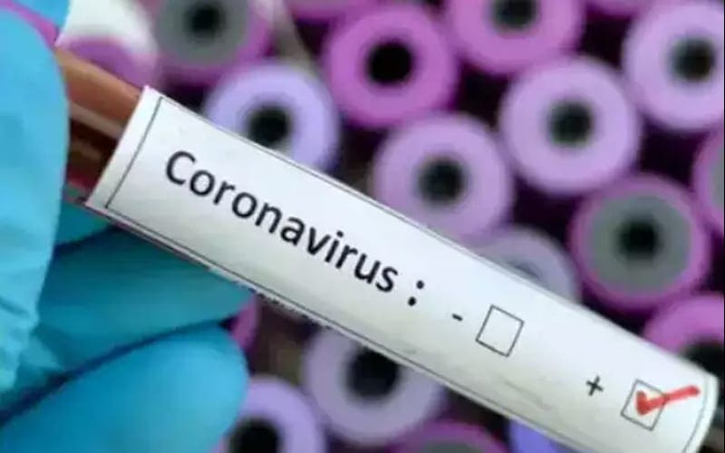 How Long WWE Knew About Positive Coronavirus Case In Company