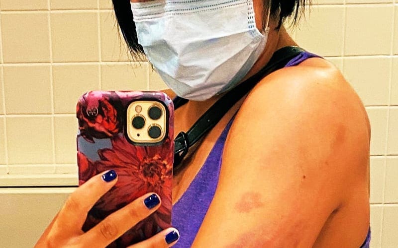 Bayley Shares Gnarly Bruises After Sasha Banks’ WWE Clash Of Champions Attack