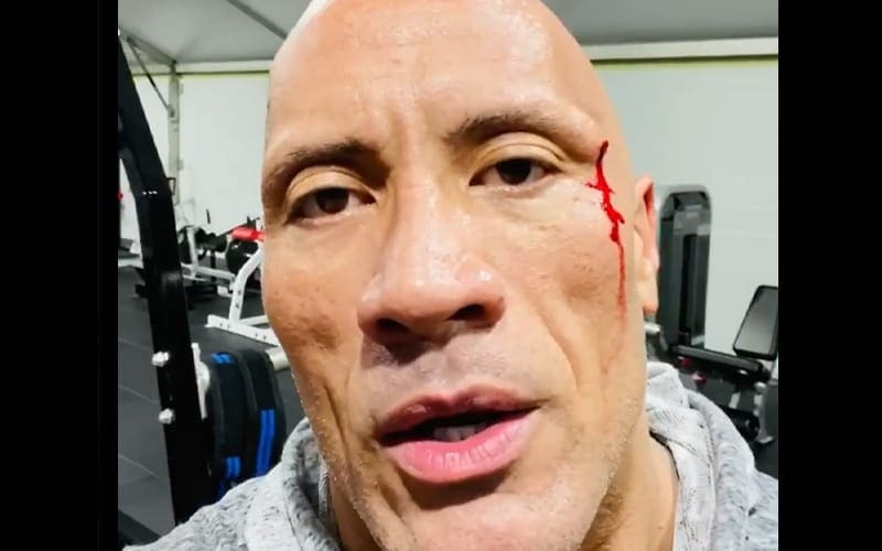 The Rock Busts Head Open In Gym Accident & Tastes His Own Blood