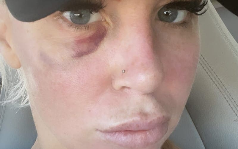Dana Brooke Shows Off Bruised Face Following Match With Reckoning On WWE RAW