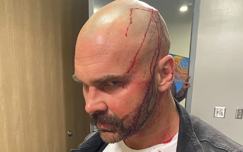 Dax Harwood Shows Off Gruesome Photos Of Bloody Head Injury After AEW Dynamite