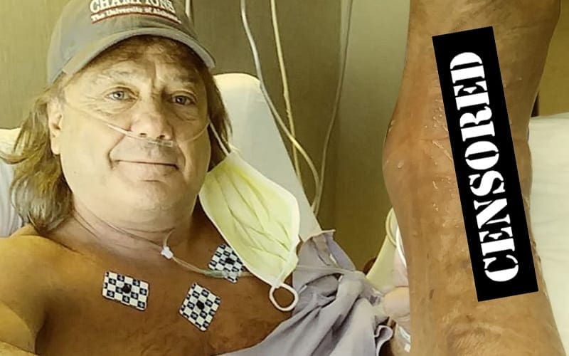 Marty Jannetty Shares New Photos After Ankle Surgery