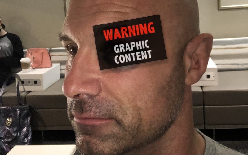 Christopher Daniels Shows Off Nasty Battle Wound After Loss On AEW Dynamite