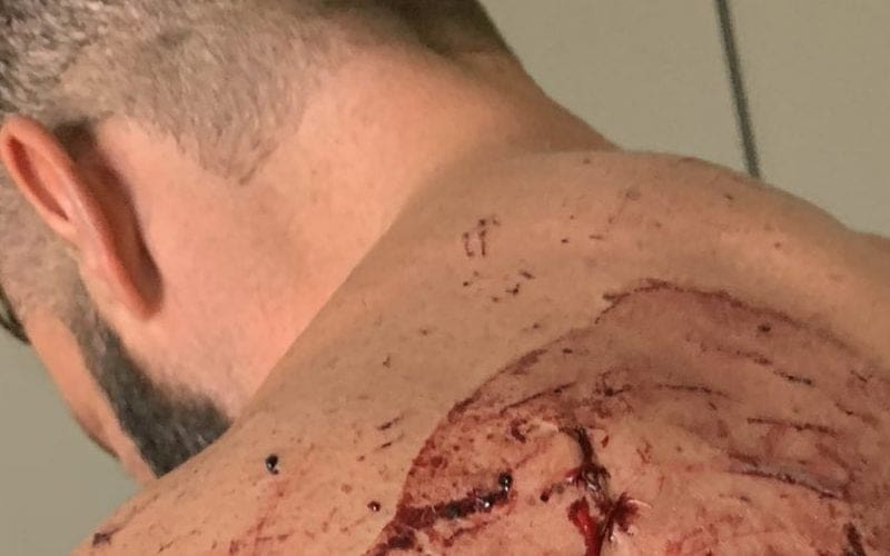 NASTY Photos Of Matt Cardona’s Wounds After GCW Homecoming