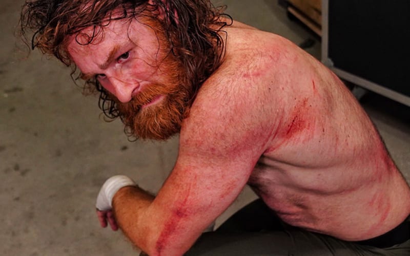 Sami Zayn Shows Off NASTY Wounds After Last Man Standing Match On WWE Smackdown