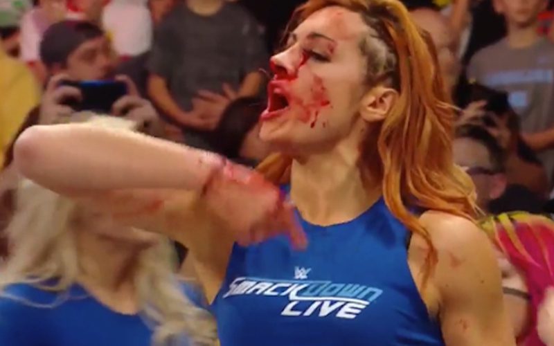 Becky Lynch Says Nia Jax Breaking Her Nose Was ‘A Blessing In Disguise’