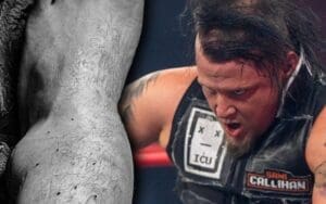 Sami Callihan Shows Off Gnarly Image Of Broken Ankle