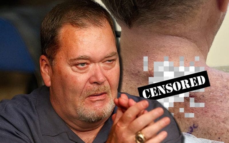 Jim Ross Shares Image Of His Back After Injury