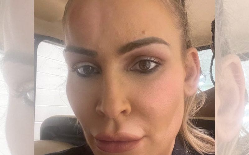 Natalya Shows Off Nasty Bump On Her Head After Royal Rumble Match