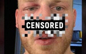 Ridge Holland Shows Off Photo Of His WWE Day 1 Nose Injury