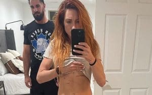 Becky Lynch Shows Off Her Healing Battle Scars & Roux Can't Even Look At The Damage
