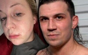 Kimber Lee Accuses Nash Carter Of Abuse & Shows Photographic Evidence