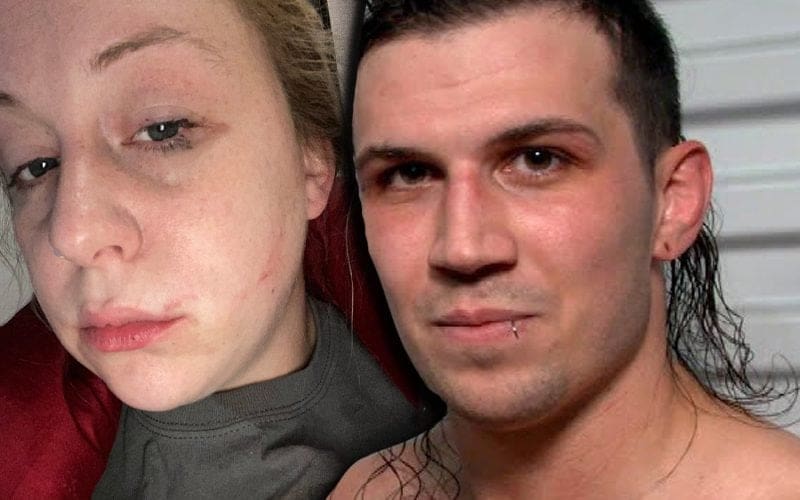 Kimber Lee Accuses Nash Carter Of Abuse & Shows Photographic Evidence