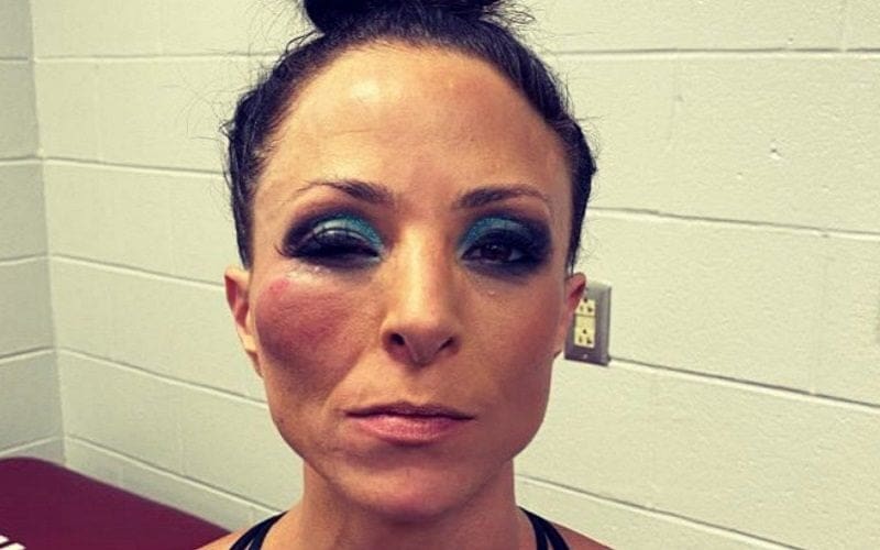 Serena Deeb Shows Off Busted Face After Street Fight With Hikaru Shida
