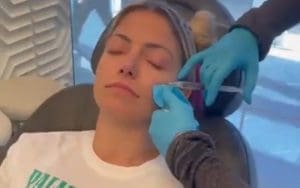 Alexa Bliss Shows Off Her ‘Red Face’ After Microneedling Procedure Alexa Bliss Shows Off Her 'Red Face' After Microneedling Procedure