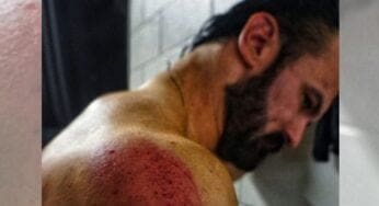 Drew McIntyre Shows Off Ridiculous Bruises After Brutal Attack On SmackDown