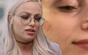 Liv Morgan Shows Off Nasty Bruises After Vicious Shayna Baszler Attack Liv Morgan Shows Off Nasty Bruises After Vicious Shayna Baszler Attack