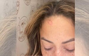 Kayla Braxton Sustains Mysterious Head Injury In Las Vegas