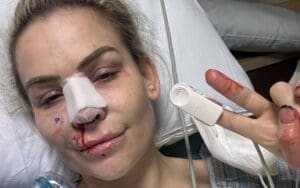 Natalya Says Doctors Had To Reset Her Nose After Bad Dislocation