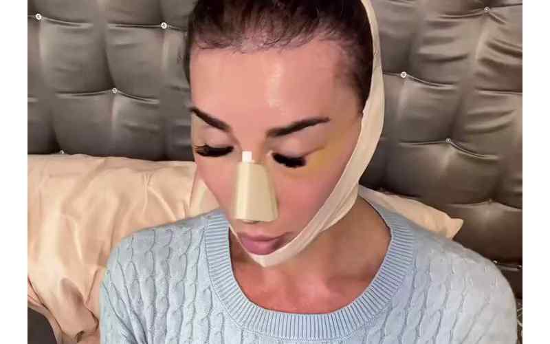 Gabbi Tuft Shares Recovery Update After Painful Cosmetic Surgery