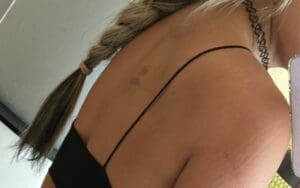Liv Morgan Shows Battle Scars Received From Shayna Baszler Liv Morgan Shows Battle Scars Received From Shayna Baszler