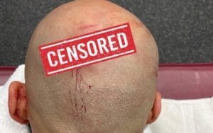 Ricochet Shows Off Nasty Stitches After WWE SmackDown Ricochet Shows Off Nasty Stitches After WWE SmackDown