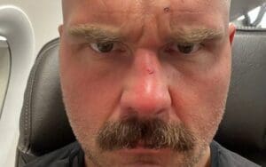 Dax Harwood Shows Off Battle Marks After Brutal ROH Final Battle Match