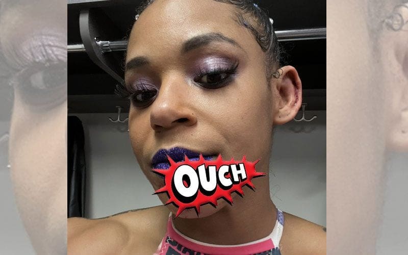 Bianca Belair Shows Stitches After Alexa Bliss’ Attack On WWE RAW
