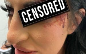 Sonya Deville Shows Off Nasty Cut After WWE Royal Rumble Match Sonya Deville Shows Off Nasty Cut After WWE Royal Rumble Match