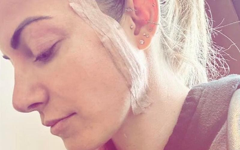 Alexa Bliss Reveals Recent Facial Procedure