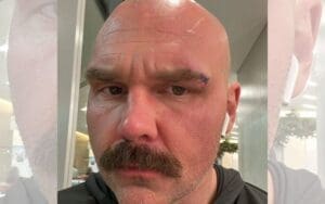 Dax Harwood Jokes About Getting Busted Open During AEW Revolution Return