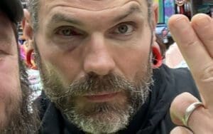 Jeff Hardy Undergoes Eye Surgery During AEW Hiatus